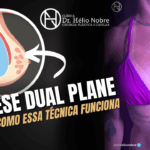 Prótese Dual Plane: entenda como essa técnica funciona