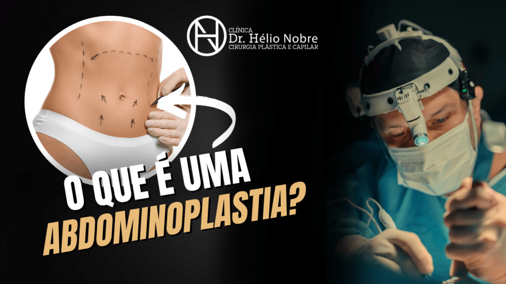 O que é uma abdominoplastia?